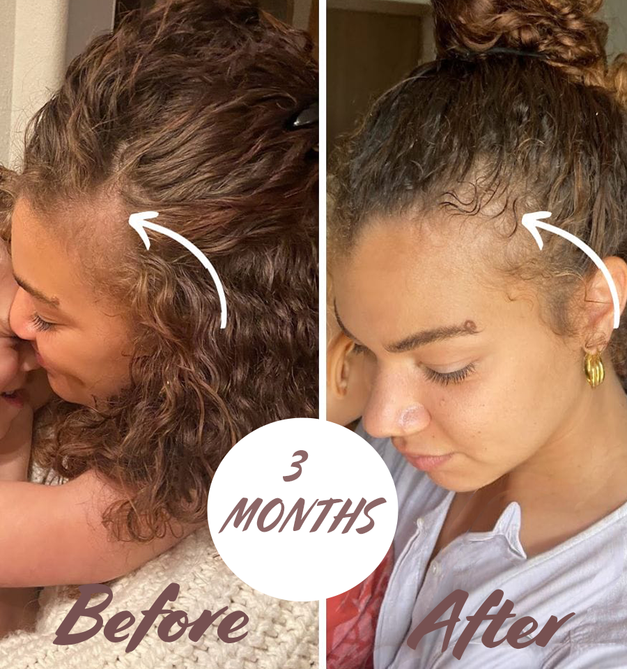 Florelle Hair Growth Oil