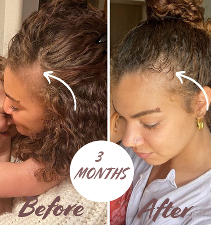 Florelle Hair Growth Oil