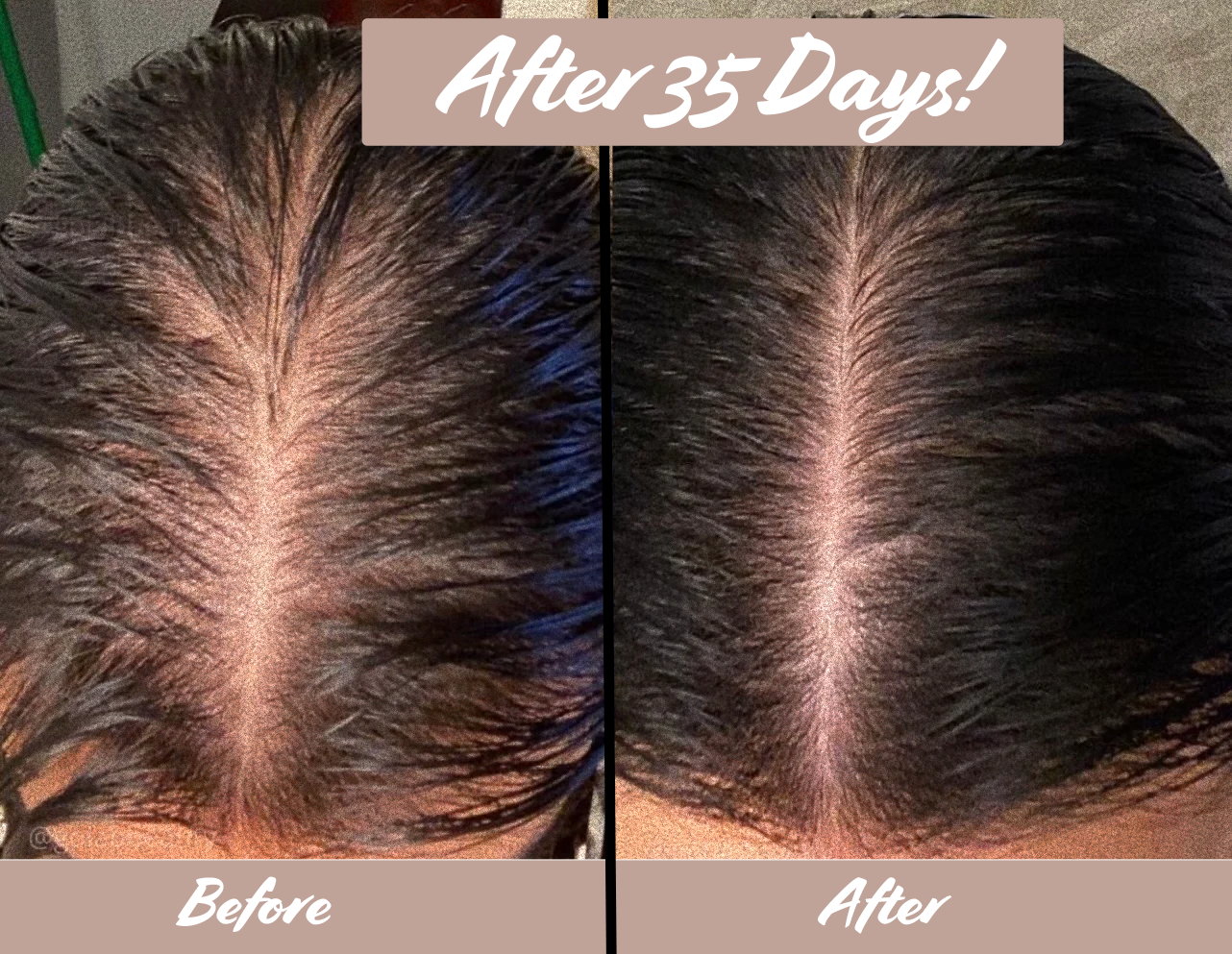 Florelle Hair Growth Oil
