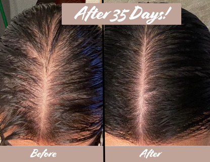 Florelle Hair Growth Oil